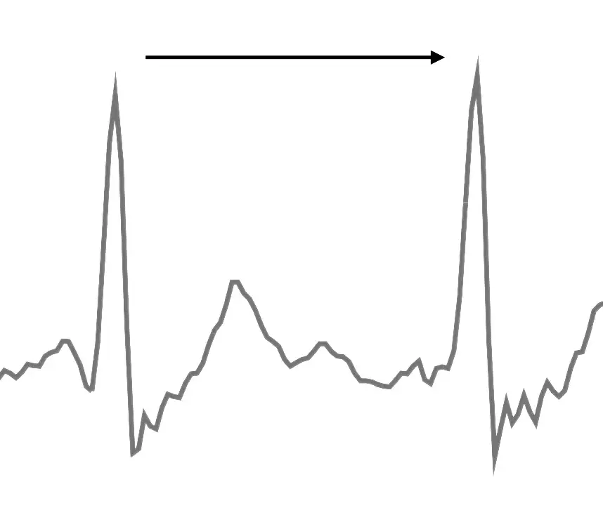 graph for HRV measuring