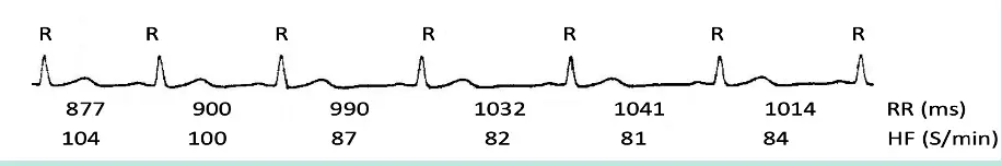 graphs showing heart rate (HF) and heart rate variability (RR)